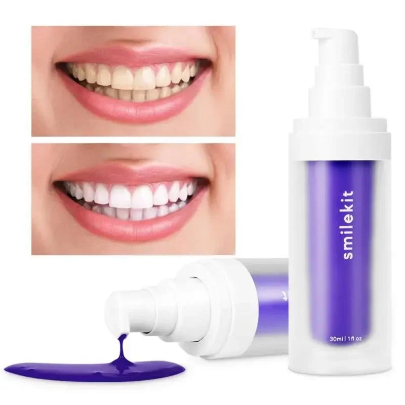 Sonrisa Radiante al Instante: V34 Blanqueador Dental